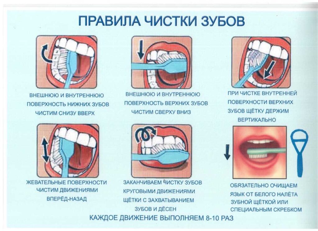 Советы стоматологов по чистке зубов